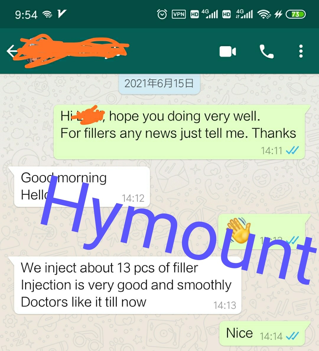 Latest company case about Hyaluronic acid dermal filler feedback