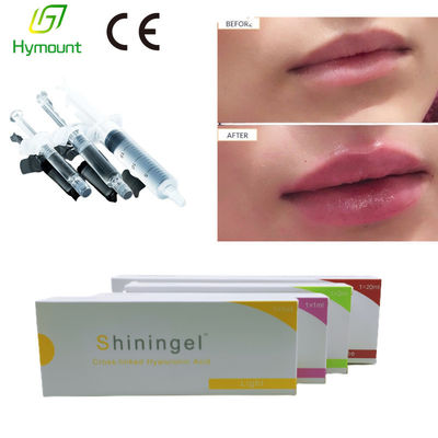 Biological Fermentation 2ml Dermal Filler Hyaluronic Acid Smooth Out Lines