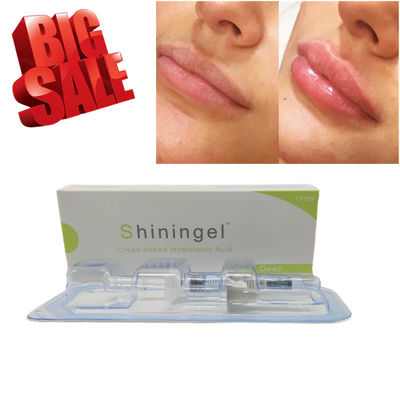 2ml Cross Linked Dermal Filler