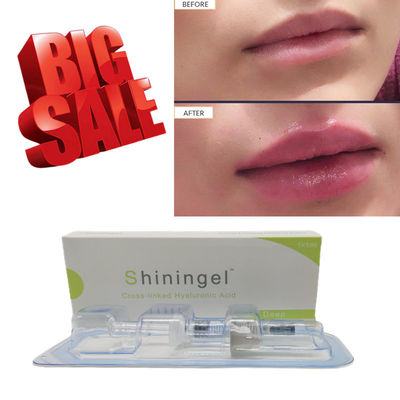 CE 24mg/Ml Anti Aging Hyaluronic Acid Lip Fillers Deep OEM ODM