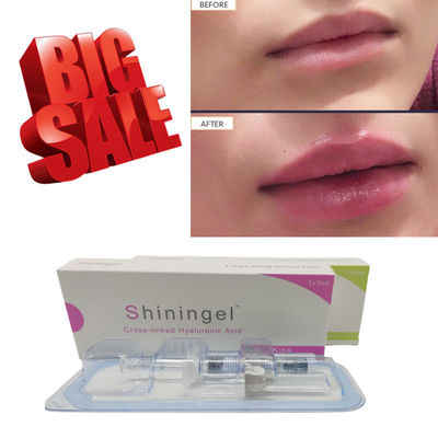 EDQM Instant Deep Hyaluronic Acid Wrinkle Fillers For Under Eye