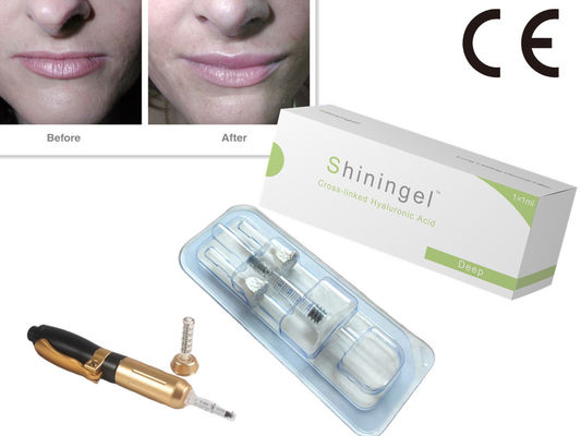 0.3% Lidocaine FDA Hyaluronic Acid Gel Filler For Fine Lines