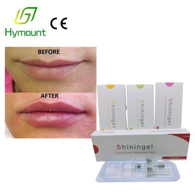 FDA Pure Sodium Hyaluronate 0.5ml Lip Filler Under Eye Filler Injection For Dark Circles