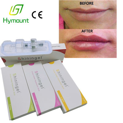 OEM ODM Hyaluron Pen Lip Injection Hyaluronic Acid Upper Eyelid Filler For Lips