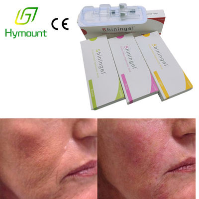 Shiningel 2ml Injectable Hyaluronic Acid Filler 26G Needles Face Sculpting Injections