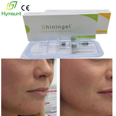 10cc Acne Scars Hyaluronic Acid Facial Fillers 0.5-1.25mm Particle