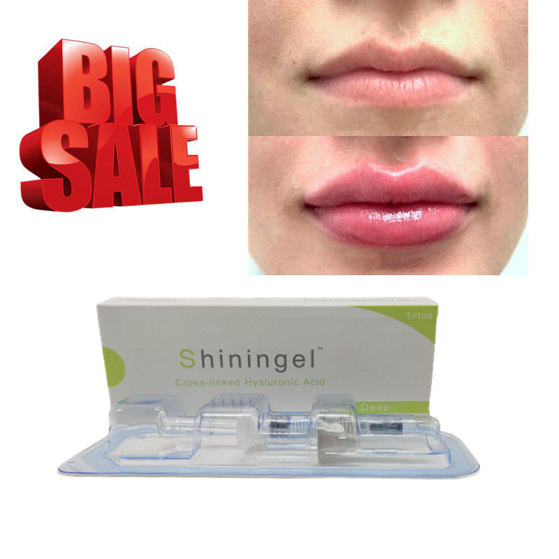 0.3% Lidocaine Injectable Sodium Hyaluronate Gel 2ml Jaw And Chin Filler