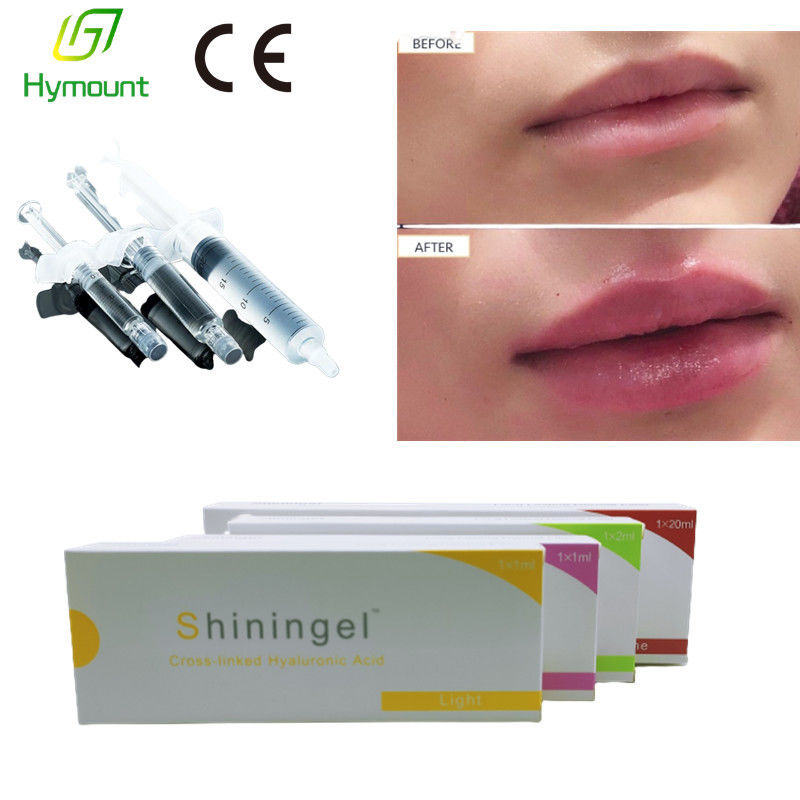 Biological Fermentation 2ml Dermal Filler Hyaluronic Acid Smooth Out Lines