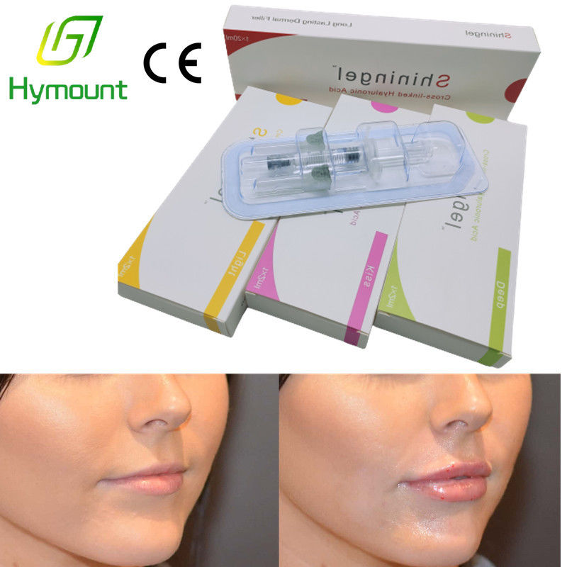 5ml Tear Trough Hyaluronic Acid Injectable Filler OEM