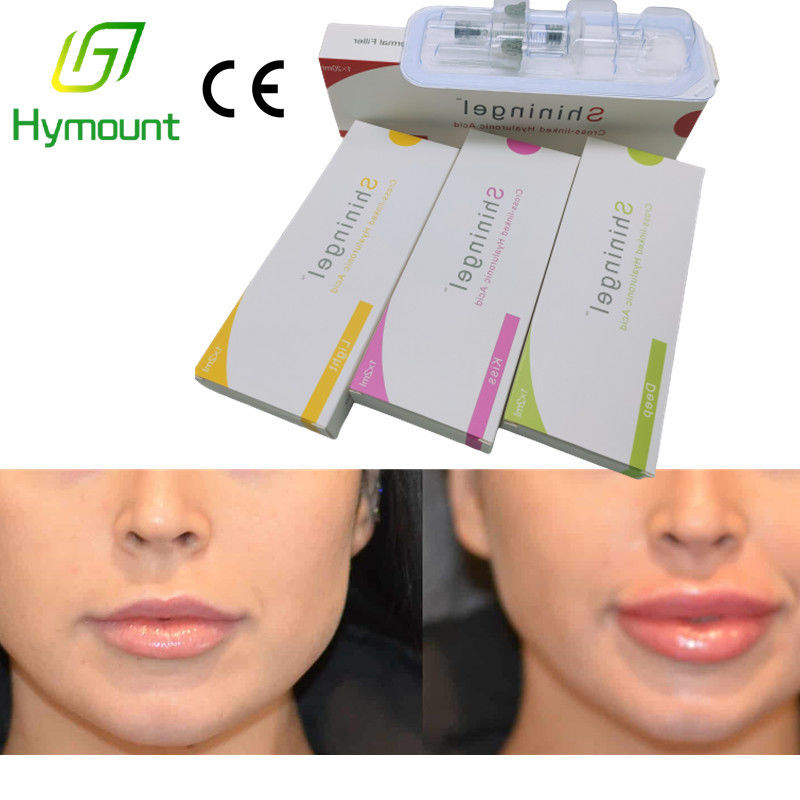 OEM Hyaluronic Acid Eye Fillers