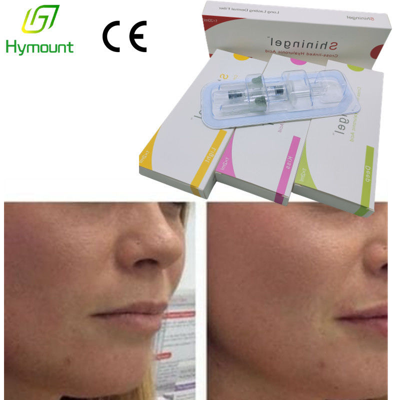 2ml Deep Hyaluronic Acid Lip Injections Lip Filler For Hyaluron Pen