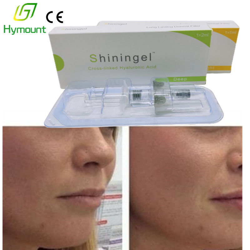 10cc Acne Scars Hyaluronic Acid Facial Fillers 0.5-1.25mm Particle