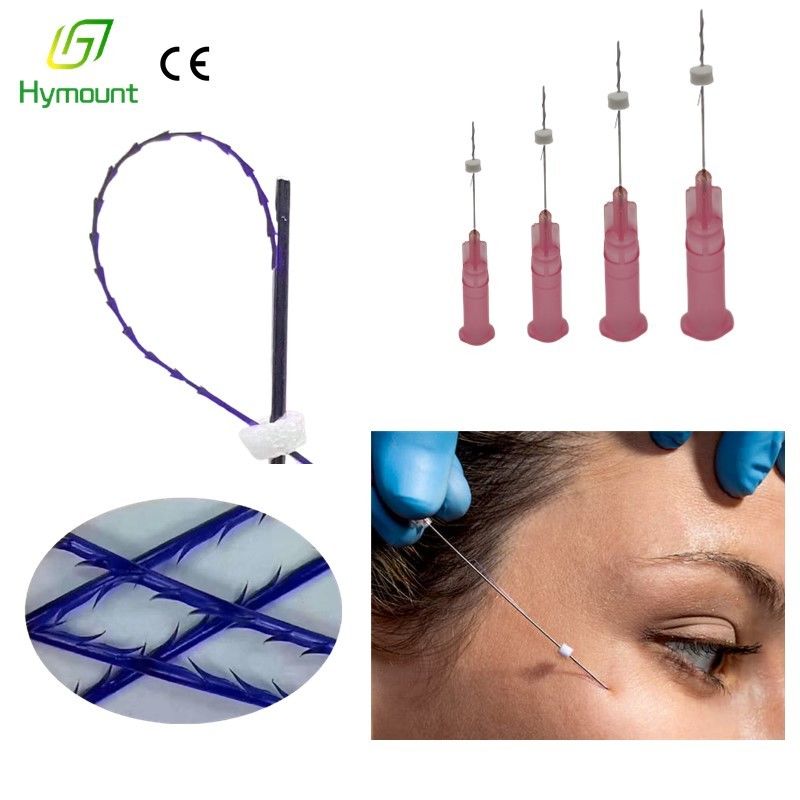 21G 38mm Minerva PDO Thread Face Lift For Foxy Eyes