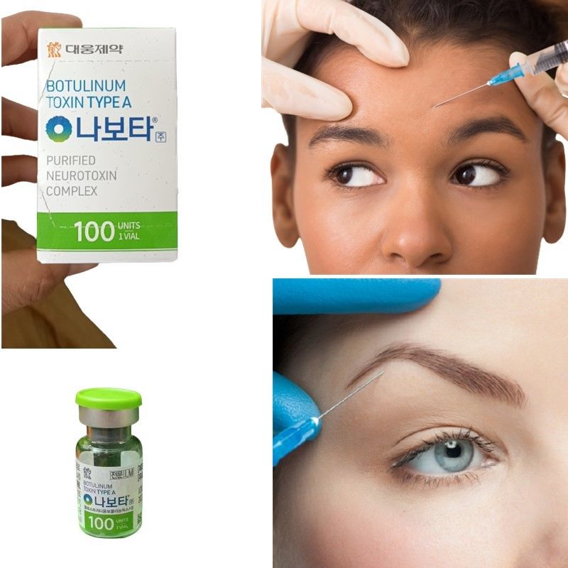 Anti Aging Nabota Botulinum Toxin Injections For Bunny Lines